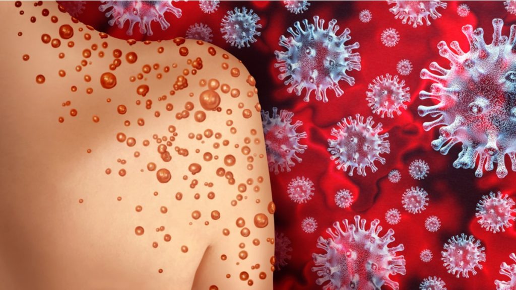 DRC approves 02 vaccines against monkeypox epidemic